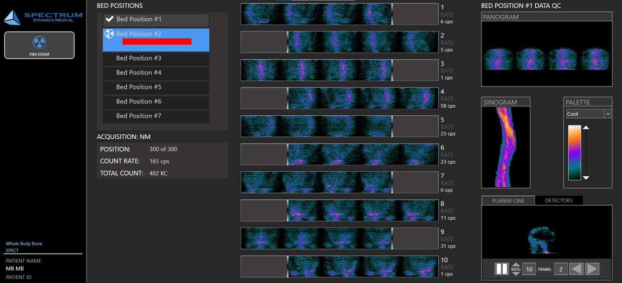 Whole Body Scan