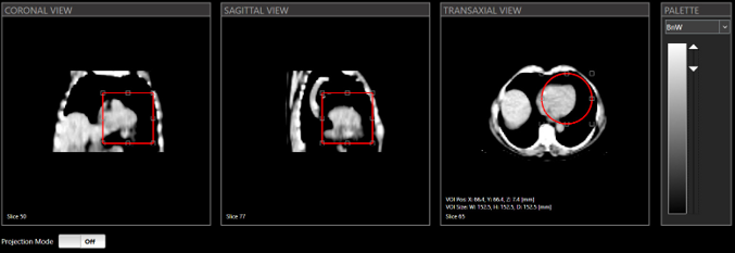 Cardiac Preview Scan
